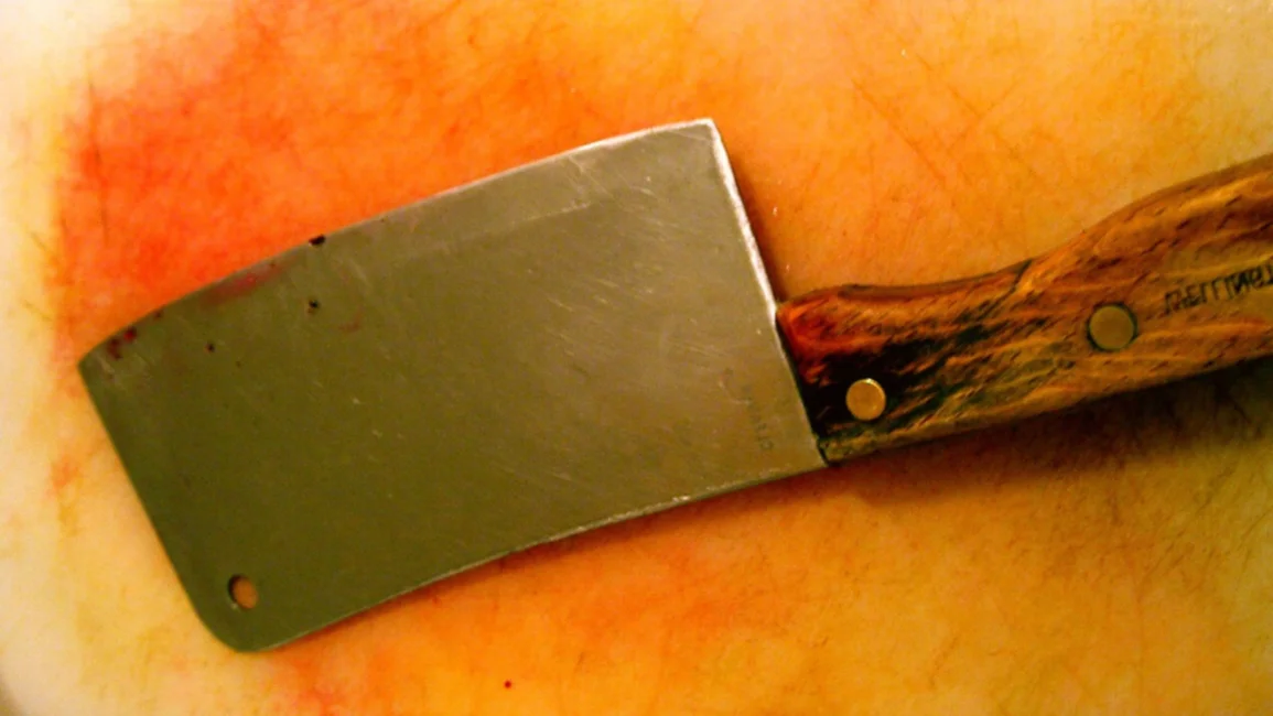 Una mujer atacó a su novio con un cuchillo carnicero: lo hirió en el pene