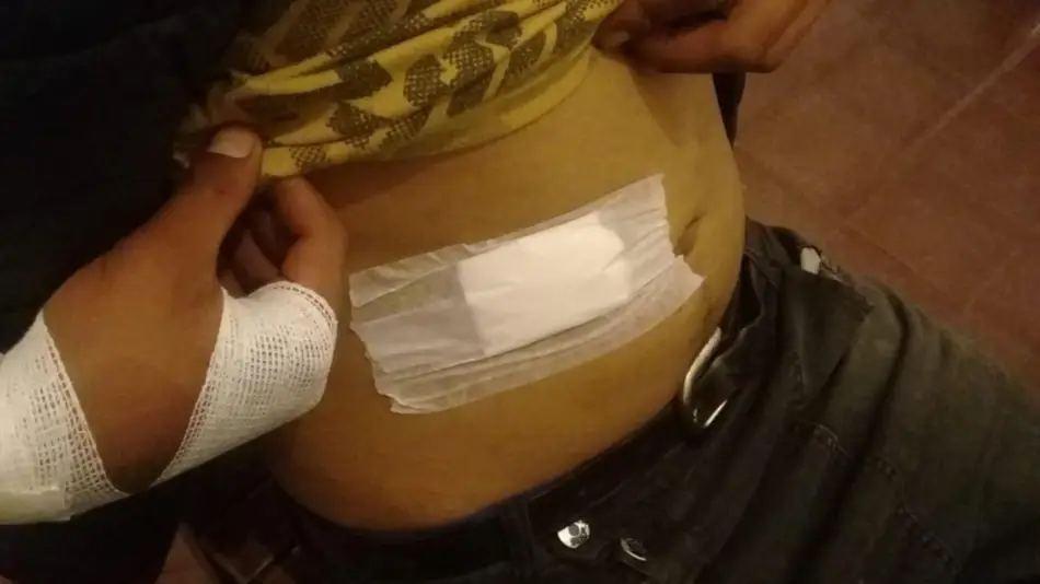 Apuñaló a un joven para robarle el celular en el B3