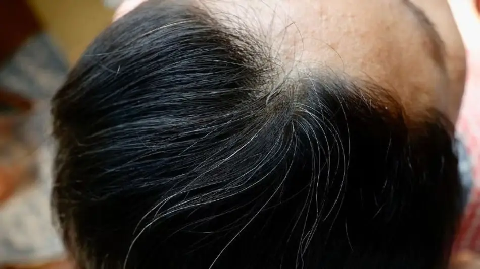 ¿Cómo usar el aceite de oliva para ocultar las canas en minutos?